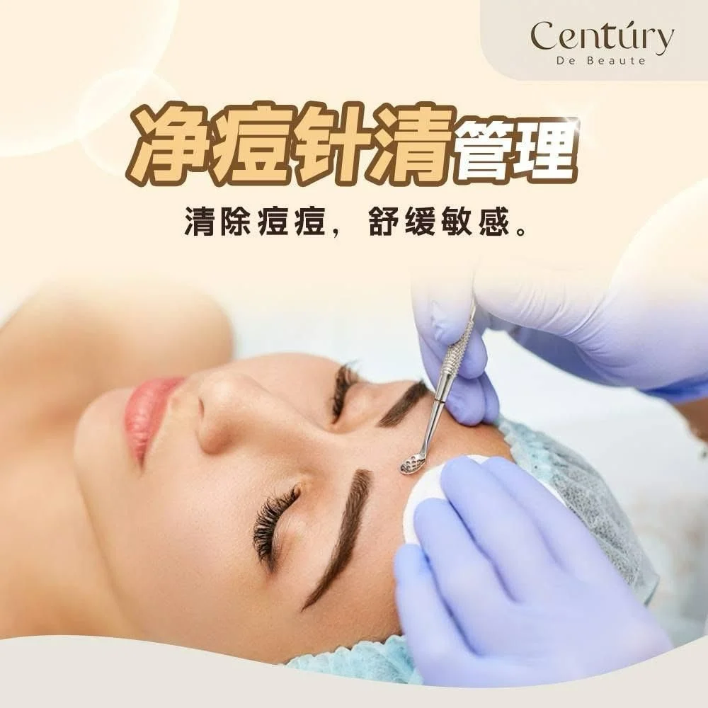 Acne Clear Injection Therapy 净痘针清管理