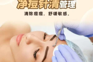 Acne Clear Injection Therapy 净痘针清管理