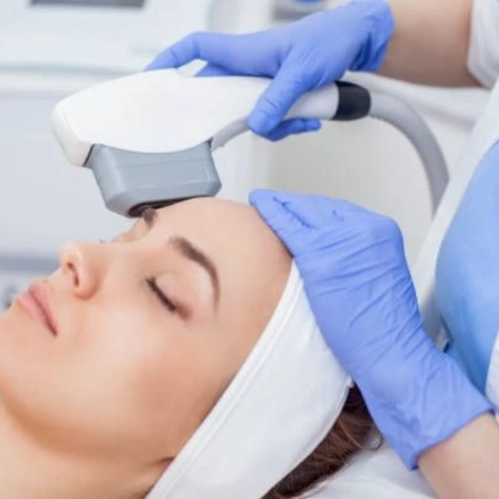 Intense Pulsed Light (IPL) Therapy 强脉冲光疗法